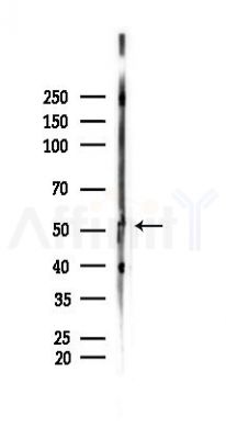 Phospho-PTEN (Ser370) Antibody - Western blot analysis of lysates from Rat brain, using Phospho-PTEN (Ser370) Antibody at 1/1000 dilution.