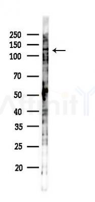 Phospho-FAK (Tyr397) Antibody - Western blot analysis of lysates from K562 cells(UV,30min treatment), using Phospho-FAK (Tyr397) Antibody at 1/1000 dilution.