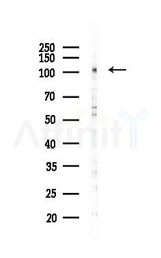 Phospho-FAK (Tyr861) Antibody - Western blot analysis of lysates from HUVEC cells(LPS 4h treatment), using Phospho-FAK (Tyr861) Antibody at 1/1000 dilution.