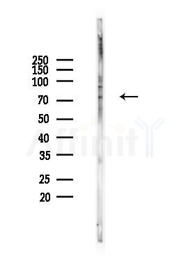Phospho-PKC delta (Ser645) Antibody - Western blot analysis of lysates from B16F10-LUC cells(heat-shock 45min treatment), using Phospho-PKC delta (Ser645) Antibody at 1/1000 dilution.