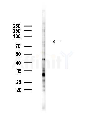 Phospho-PKC delta (Tyr64) Antibody - Western blot analysis of lysates from K562 cells(UV 30min treatment), using Phospho-PKC delta (Tyr64) Antibody at 1/1000 dilution.