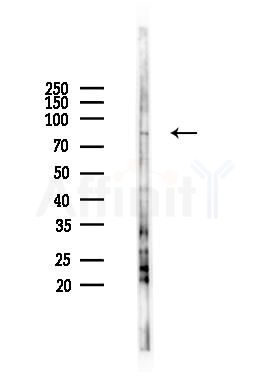 Phospho-PKC delta (Tyr64) Antibody - Western blot analysis of lysates from B16F10-LUC cells(heat-shock 45min treatment), using Phospho-PKC delta (Tyr64) Antibody at 1/1000 dilution.