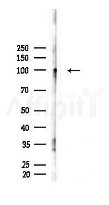 Phospho-GAB1 (Tyr627) Antibody - Western blot analysis of lysates from Mouse liver, using Phospho-GAB1 (Tyr627) Antibody at 1/1000 dilution.
