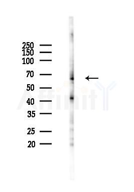 Phospho-HDAC1 (Ser421) Antibody - Western blot analysis of lysates from B16F10-LUC cells(heat-shock 45min treatment), using Phospho-HDAC1 (Ser421) Antibody at 1/1000 dilution.