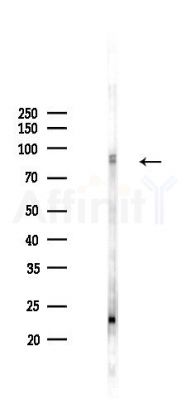 Phospho-Cortactin (Tyr421) Antibody - Western blot analysis of lysates from Mouse lung, using Phospho-Cortactin (Tyr421) Antibody at 1/1000 dilution.