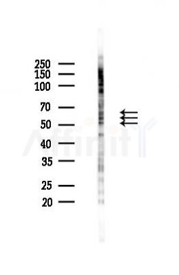 Phospho-Smad2 (Ser250) Antibody - Western blot analysis of lysates from K562 cells(UV 30min treatment), using Phospho-Smad2 (Ser250) Antibody at 1/1000 dilution.