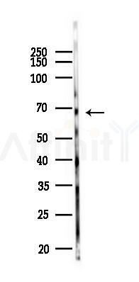 Phospho-BLNK (Tyr96) Antibody - Western blot analysis of lysates from Rat testis, using Phospho-BLNK (Tyr96) Antibody at 1/1000 dilution.