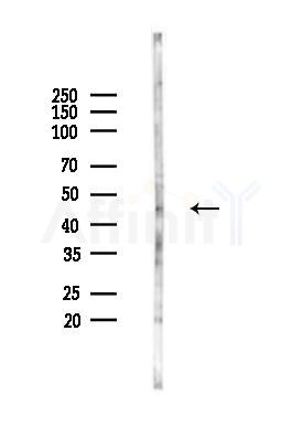 Phospho-CaMKII alpha/delta (Thr286) Antibody - Western blot analysis of lysates from K562 cells(UV 30min treatment), using Phospho-CaMKII alpha/delta (Thr286) Antibody at 1/1000 dilution.