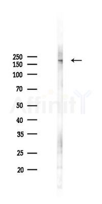 Phospho-MAP3K4 (Ser499) Antibody - Western blot analysis of lysates from Mouse lung, using Phospho-MAP3K4 (Ser499) Antibody at 1/1000 dilution.