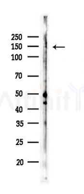 Phospho-KDM3A (Tyr1114) Antibody - Western blot analysis of lysates from K562 cells(UV,30min treatment), using Phospho-KDM3A (Tyr1114) Antibody at 1/1000 dilution.