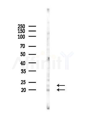 Phospho-ASF1A (Ser166) Antibody - Western blot analysis of lysates from K562 cells(UV 30min treatment), using Phospho-ASF1A (Ser166) Antibody at 1/1000 dilution.