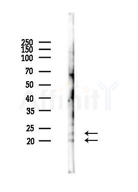 Phospho-ASF1A (Ser166) Antibody - Western blot analysis of lysates from B16F10-LUC cells(heat-shock 45min treatment), using Phospho-ASF1A (Ser166) Antibody at 1/1000 dilution.