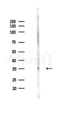 Phospho-DARPP32 (Ser137) Antibody - Western blot analysis of lysates from Rat brain, using Phospho-DARPP32 (Ser137) Antibody at 1/1000 dilution.