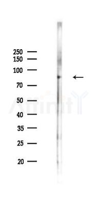 Phospho-GABBR1 (Ser923) Antibody - Western blot analysis of lysates from PC12 cells(LPS 4h treatment), using Phospho-GABBR1 (Ser923) Antibody at 1/1000 dilution.