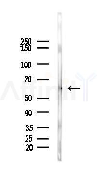 Phospho-RIP3 (Thr187) Antibody - Western blot analysis of lysates from A2780 cells(UV,30min treatment), using Phospho-RIP3/RIPK3 (Thr187) Antibody at 1/1000 dilution.