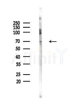 Phospho-PAK5/6 (Ser602/Ser560) Antibody - Western blot analysis of lysates from K562 cells(UV 30min treatment), using Phospho-PAK5/6 (Ser602/Ser560) Antibody at 1/1000 dilution.