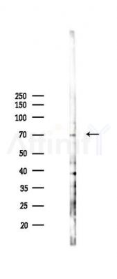 Phospho-RAD18 (Ser99) Antibody - Western blot analysis of lysates from 293 cells(LPS 4h treatment), using Phospho-RAD18 (Ser99) Antibody at 1/1000 dilution.
