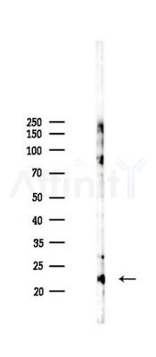 Phospho-TOMM22 (Thr43) Antibody - Western blot analysis of lysates from 293 cells(LPS 4h treatment), using Phospho-TOMM22 (Ser43) Antibody at 1/1000 dilution.