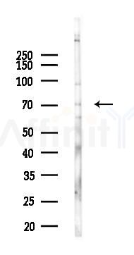 Phospho-SPHK2 (Ser387) Antibody - Western blot analysis of lysates from A2780 cells(UV,30min treatment), using Phospho-SPHK2 (Ser387) Antibody at 1/1000 dilution.
