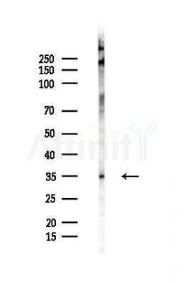 Phospho-Nanog (Thr280) Antibody - Western blot analysis of lysates from B16F10-LUC cells(starvation 24h treatment), using Phospho-Nanog (Thr280) Antibody at 1/1000 dilution.