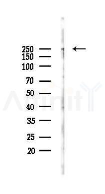 Phospho-WNK1 (Thr60) Antibody - Western blot analysis of lysates from PC12 cells(LPS 4h treatment), using Phospho-WNK1 (Thr60) Antibody at 1/1000 dilution.