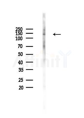Phospho-HIPK2 (Thr273) Antibody - Western blot analysis of lysates from B16F10-LUC cells(heat-shock 45min treatment), using Phospho-HIPK2 (Thr273) Antibody at 1/1000 dilution.