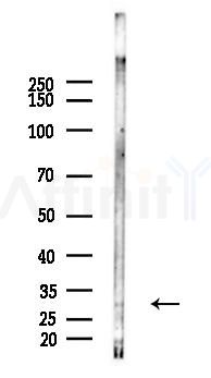Phospho-FGF23 (Ser212) Antibody - Western blot analysis of lysates from RAW264.