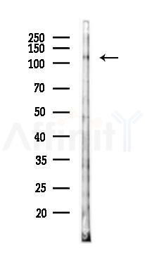 Phospho-ASK1 (Thr845) Antibody - Western blot analysis of lysates from HUVEC cells(LPS 4h treatment), using Phospho-ASK1 (Thr845) Antibody at 1/1000 dilution.