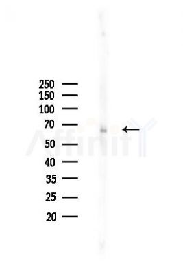 Phospho-Optineurin (Ser177) Antibody - Western blot analysis of lysates from 293 cells(LPS 4h treatment), using Phospho-Optineurin (Ser177) Antibody at 1/1000 dilution.