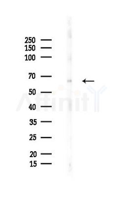 Phospho-Optineurin (Ser177) Antibody - Western blot analysis of lysates from B16F10-LUC cells(starvation 24h treatment), using Phospho-Optineurin (Ser177) Antibody at 1/1000 dilution.