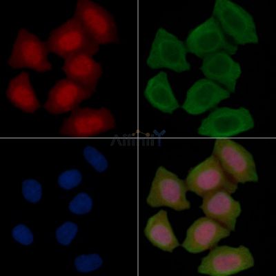 Phospho-Optineurin (Ser177) Antibody - AF3560 staining Hela cells(45min of heat-shock treatment) by IF/ICC.