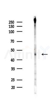 Phospho-SIRT2 (Ser368) Antibody - Western blot analysis of lysates from COLO205 cells(UV 30min treatment), using Phospho-SIRT2 (Ser368) Antibody at 1/1000 dilution.