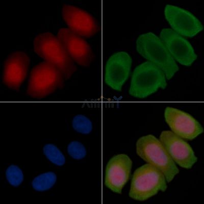 Phospho-CRTC3 (Ser162) Antibody - AF3576 staining Hela cells(45min of heat-shock treatment) by IF/ICC.