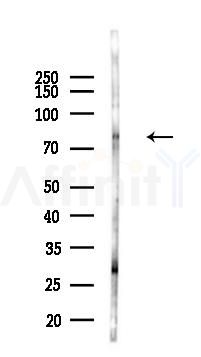 Phospho-TORC2 (Ser275) Antibody - Western blot analysis of lysates from A2780 cells(UV,30min treatment), using Phospho-TORC2 (Ser275) Antibody at 1/1000 dilution.