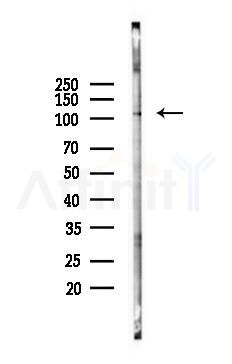 Phospho-NLRC4 (Ser533) Antibody - Western blot analysis of lysates from PC12 cells(LPS 4h treatment), using Phospho-NLRC4 (Ser533) Antibody at 1/1000 dilution.