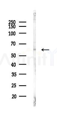 Phospho-RUNX2 (Ser319) Antibody - Western blot analysis of lysates from A2780 cells(UV,30min treatment), using Phospho-RUNX2 (Ser319) Antibody at 1/1000 dilution.