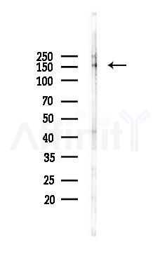 Phospho-MEKK1 (Thr1402) Antibody - Western blot analysis of lysates from PC12 cells(LPS 4h treatment), using Phospho-MEKK1 (Thr1402) Antibody at 1/1000 dilution.