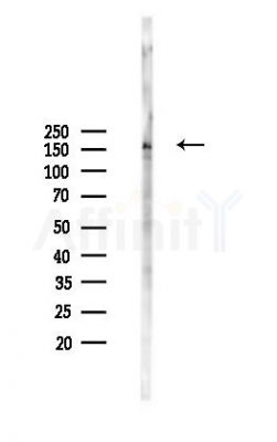 Phospho-MEKK1 (Thr1400) Antibody - Western blot analysis of lysates from 293 cells(LPS 4h treatment), using Phospho-MEKK1 (Thr1400) Antibody at 1/1000 dilution.