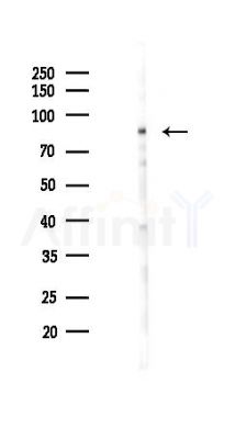 Phospho-SLP76 (Tyr128) Antibody - Western blot analysis of lysates from PC12 cells(LPS 4h treatment), using Phospho-SLP76 (Tyr128) Antibody at 1/1000 dilution.