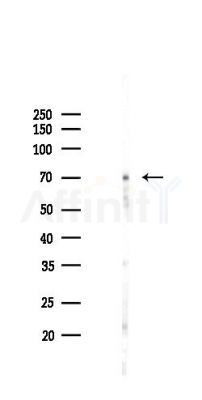 Phospho-SLP76 (Tyr128) Antibody - Western blot analysis of lysates from Mouse lung, using Phospho-SLP76 (Tyr128) Antibody at 1/1000 dilution.