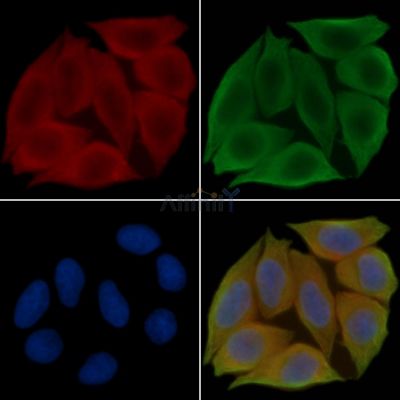 Phospho-SLP76 (Tyr128) Antibody - AF3607 staining Hela cells(45min of heat-shock treatment) by IF/ICC.