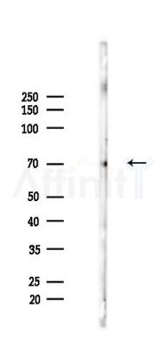 Phospho-ITK (Tyr180) Antibody - Western blot analysis of lysates from Rat brain, using Phospho-ITK (Tyr180) Antibody at 1/1000 dilution.