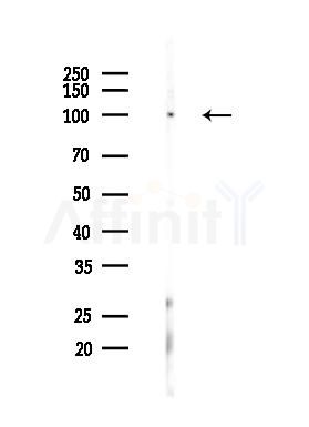 Phospho-DDR1 (Tyr180) Antibody - Western blot analysis of lysates from PC12 cells(LPS 4h treatment), using Phospho-DDR1 (Tyr180) Antibody at 1/1000 dilution.