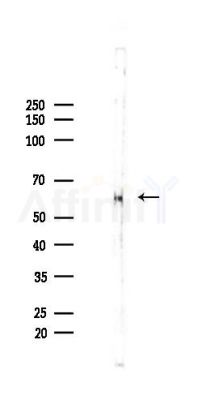 Phospho-CXCR4 (Ser339) Antibody - Western blot analysis of lysates from Rat brain, using Phospho-CXCR4 (Ser339) Antibody at 1/1000 dilution.
