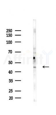Phospho-CXCR4 (Ser339) Antibody - Western blot analysis of lysates from B16F10-LUC cells(UV,30min treatment), using Phospho-CXCR4 (Ser339) Antibody at 1/1000 dilution.