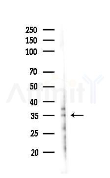 Phospho-TIRAP (Tyr106) Antibody - Western blot analysis of lysates from 293 cells(LPS 4h treatment), using Phospho-TIRAP (Tyr106) Antibody at 1/1000 dilution.