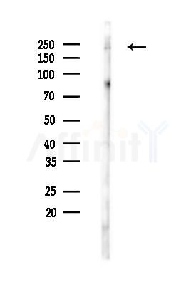 Phospho-BRG1 (Ser721) Antibody - Western blot analysis of lysates from Rat testis, using Phospho-BRG1 (Ser721) Antibody at 1/1000 dilution.