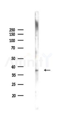 Phospho-Casein Kinase 1 alpha (Tyr294) Antibody - Western blot analysis of lysates from Mouse liver, using Phospho-Casein Kinase 1 alpha (Tyr294) Antibody at 1/1000 dilution.
