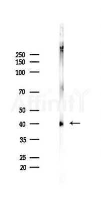 Phospho-Casein Kinase 1 alpha (Tyr294) Antibody - Western blot analysis of lysates from Rat brain, using Phospho-Casein Kinase 1 alpha (Tyr294) Antibody at 1/1000 dilution.