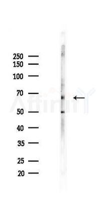 Phospho-YAP (Ser941) Antibody - Western blot analysis of lysates from B16F10-LUC cells(UV,30min treatment), using Phospho-YAP (Ser941) Antibody at 1/1000 dilution.